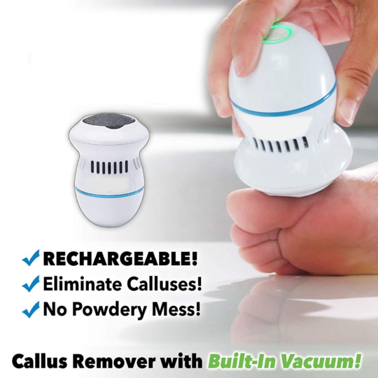 FOOT FILE AND CALLUS REMOVER WITH BUILT-IN VACUUM