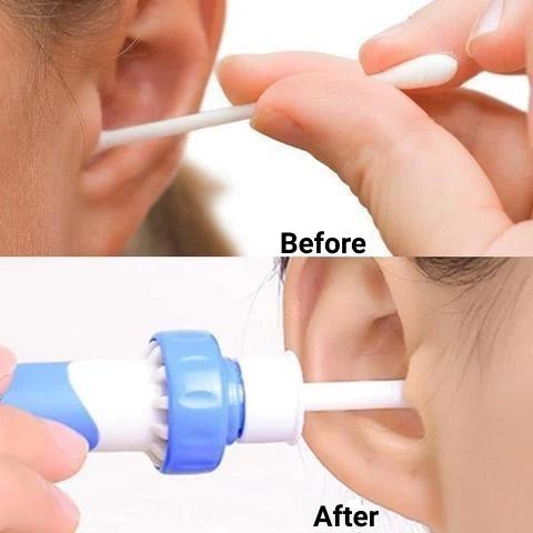 Ear Wax Vacuum