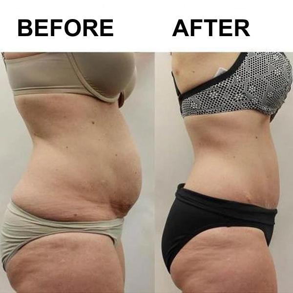 Detoxifying Slimming Patches