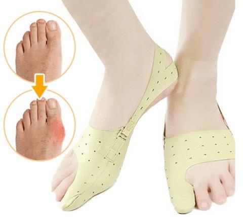Bunion Corrector